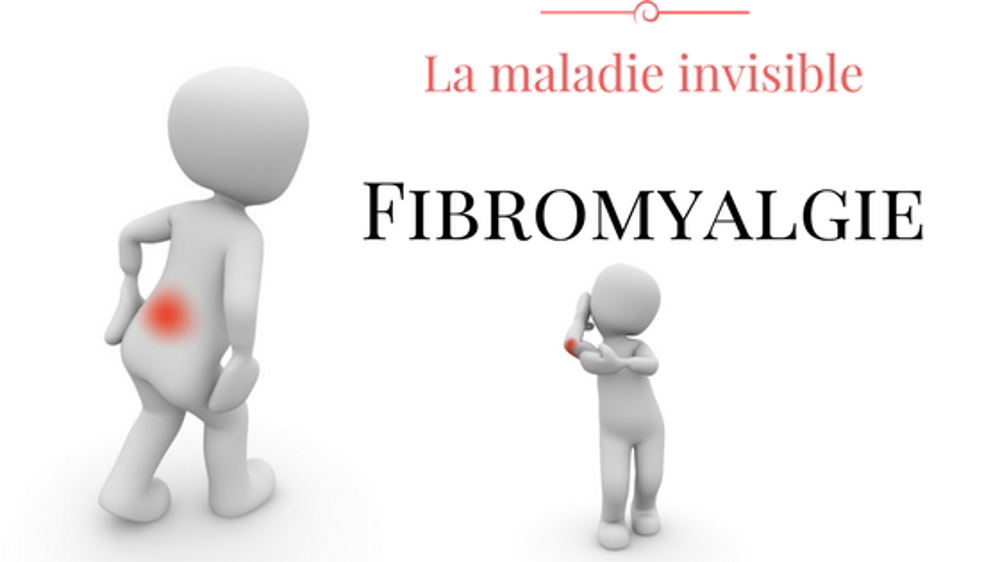 LA FIBROMYALGIE